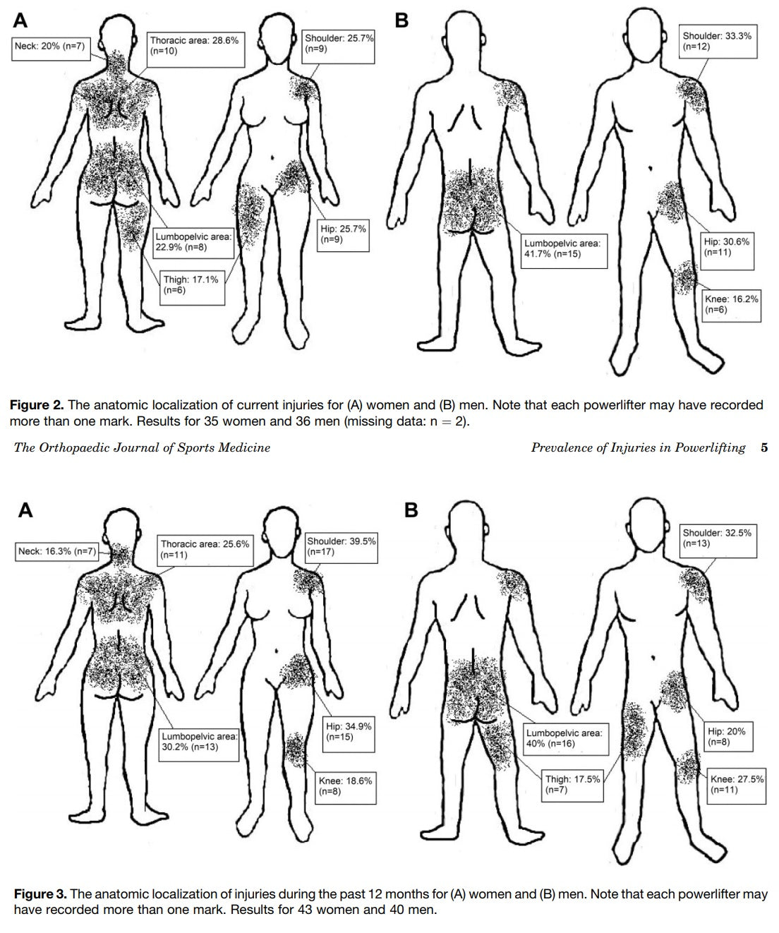 Powerlifting Injuries: Causes, Prevention & Recovery